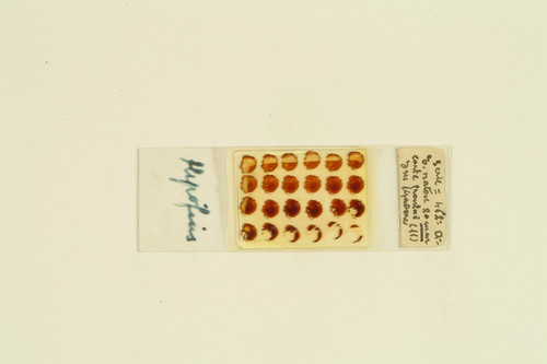 Preparación histológica de Francisco Tello. Embrión de ratón de 20 mm, corte frontal. Método de nitrato de plata reducido.